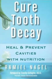 Cure Tooth Decay: Heal and Prevent Cavities With Nutrition